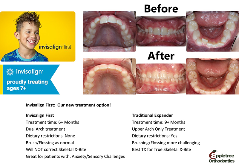 Invisalign Clear Braces  Londonderry NH Orthodontist